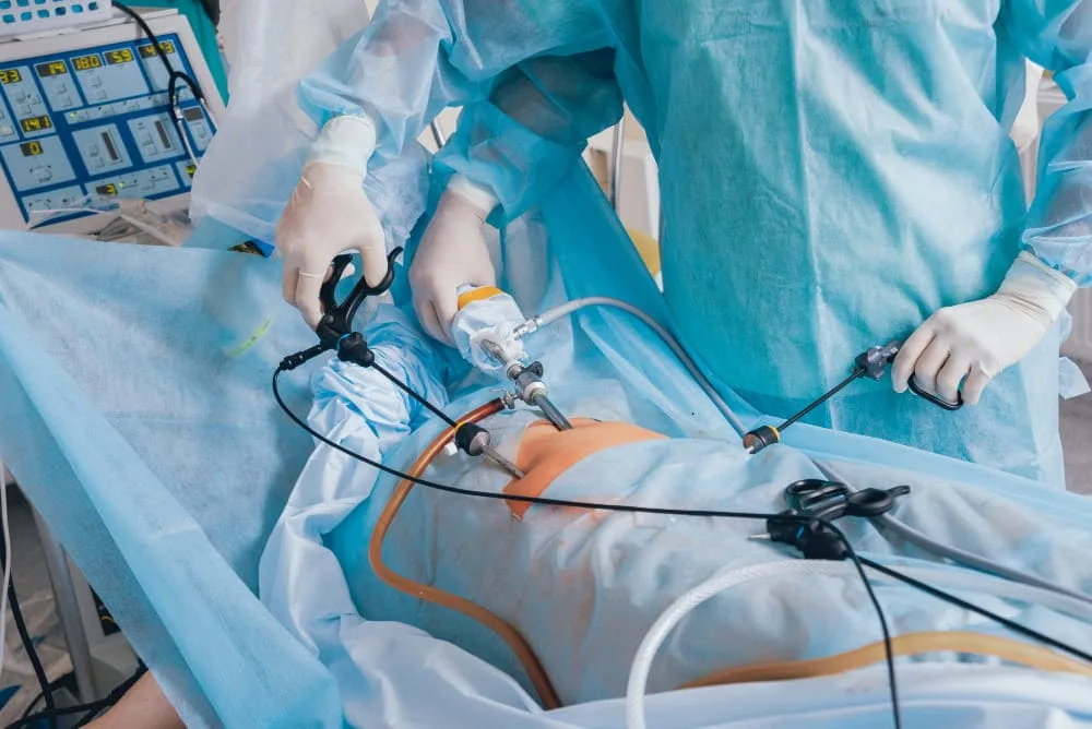 Apendicectomía en CDMX: cirugía oportuna para tratar apendicitis